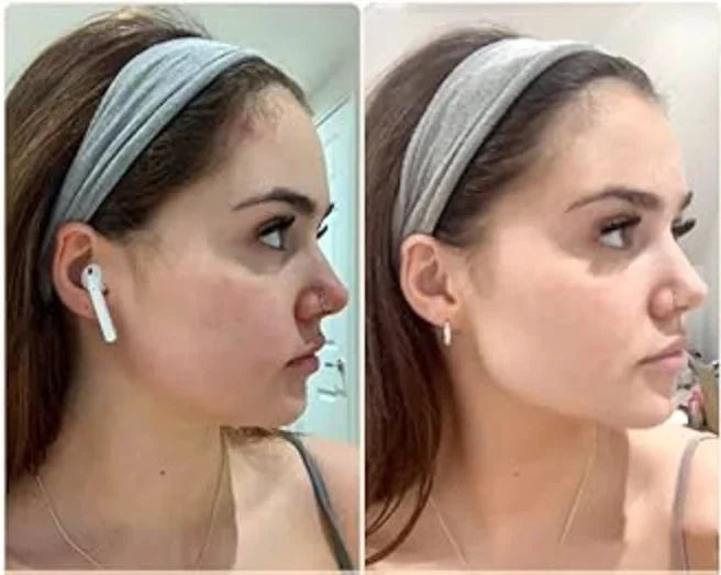 Face Massager